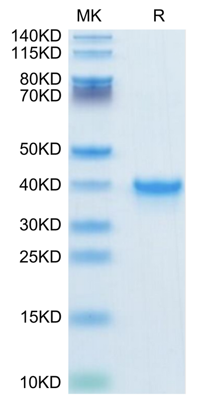Human TGF-alpha on Tris-Bis PAGE under reduced condition. The purity is greater than 95%.Recombinant Human TGF-alpha Protein, Active