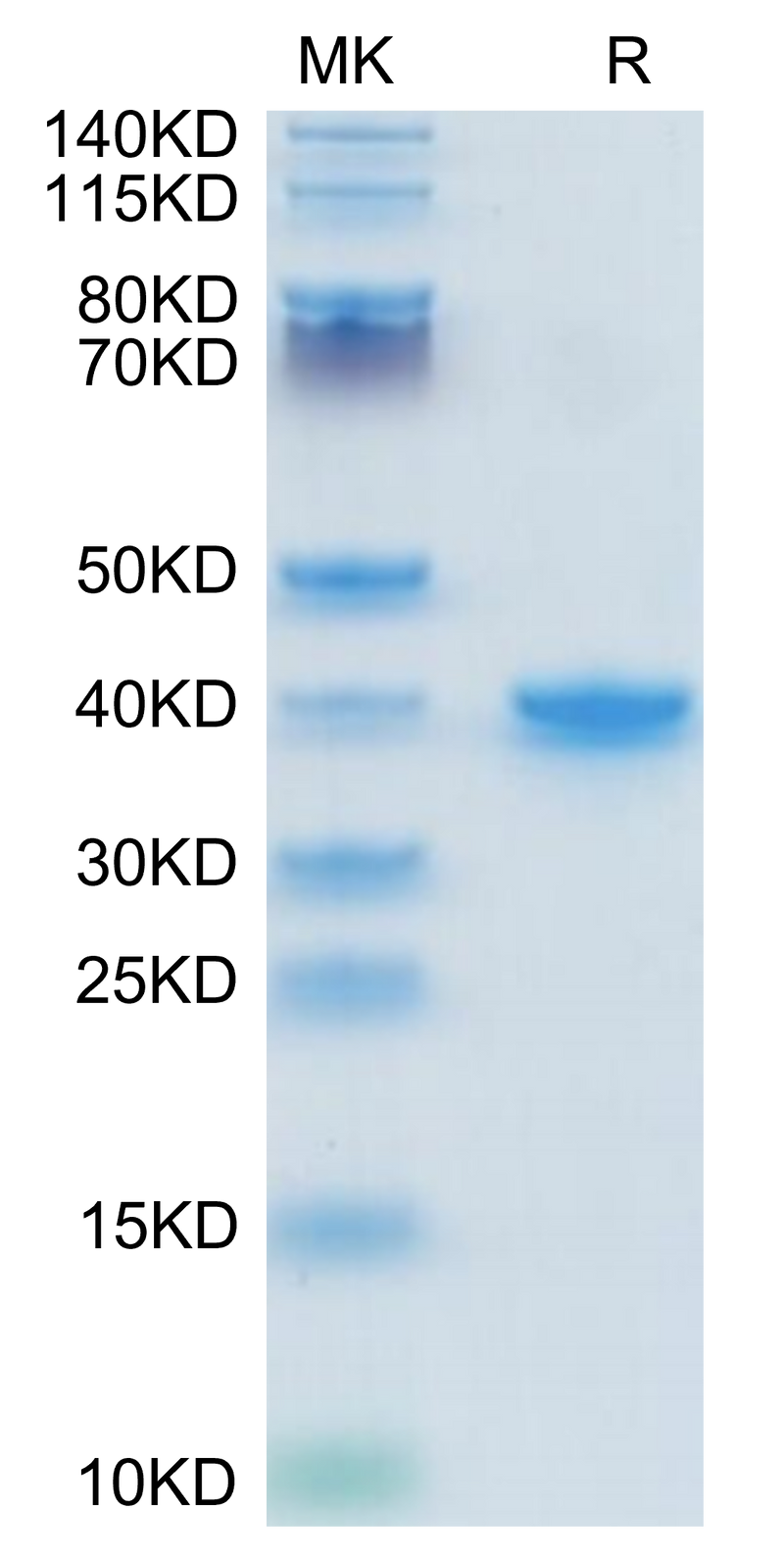 Mouse TGF-alpha on Tris-Bis PAGE under reduced condition. The purity is greater than 95%.Recombinant Mouse TGF-alpha Protein