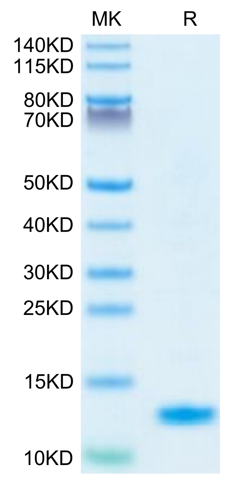 Human IL-8 on Tris-Bis PAGE under reduced condition. The purity is greater than 95%.Recombinant Human IL-8/CXCL8 Protein, Active