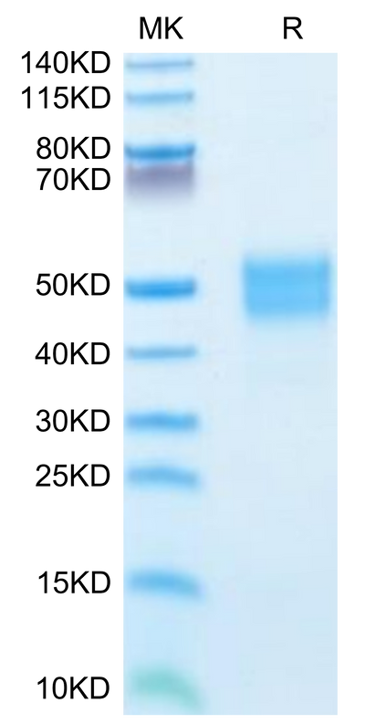 Human IGFBP-3 on Tris-Bis PAGE under reduced condition. The purity is greater than 95%.Recombinant Human IGFBP-3 Protein, Active