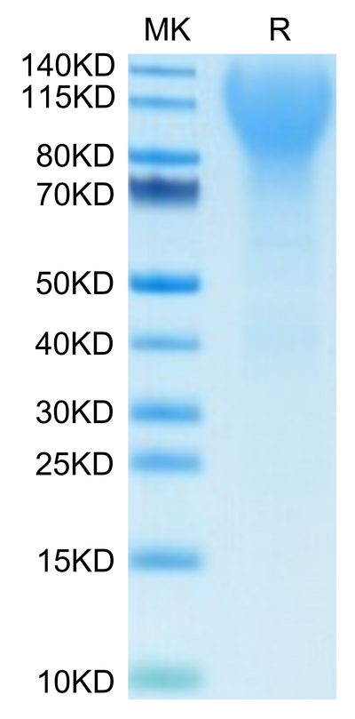 Mouse CD43 on Tris-Bis PAGE under reduced condition. The purity is greater than 95%.Recombinant Mouse CD43 Protein