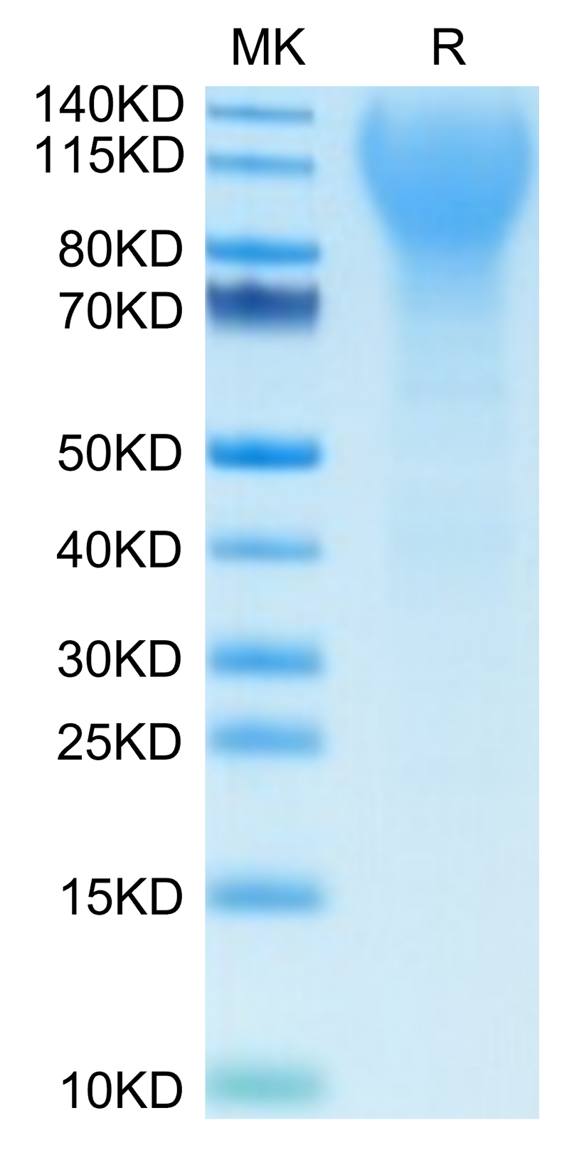 Mouse CD43 on Tris-Bis PAGE under reduced condition. The purity is greater than 95%.Recombinant Mouse CD43 Protein