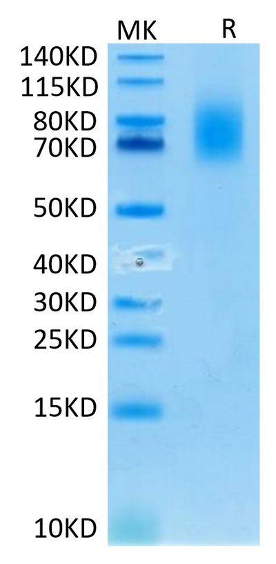 Human CD30 on Tris-Bis PAGE under reduced condition. The purity is greater than 95%.Recombinant Human CD30/TNFRSF8 Protein, Active