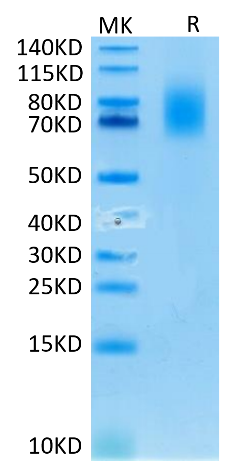 Human CD30 on Tris-Bis PAGE under reduced condition. The purity is greater than 95%.Recombinant Human CD30/TNFRSF8 Protein, Active