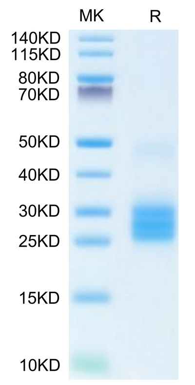 Human IL-25 on Tris-Bis PAGE under reduced condition. The purity is greater than 95%.Recombinant Human IL-25/IL-17E Protein, Active