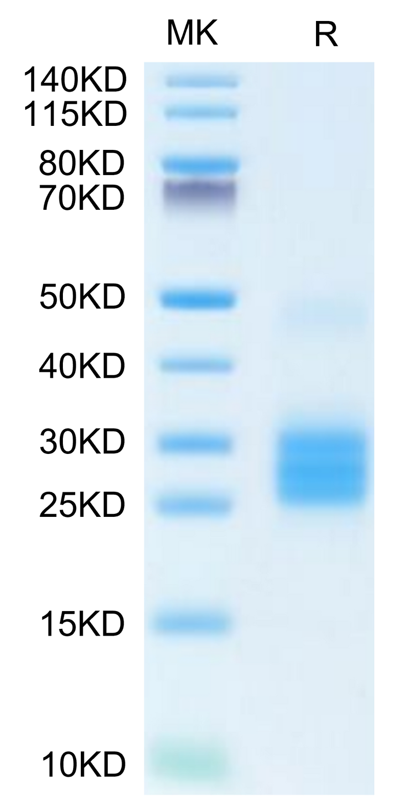 Human IL-25 on Tris-Bis PAGE under reduced condition. The purity is greater than 95%.Recombinant Human IL-25/IL-17E Protein, Active