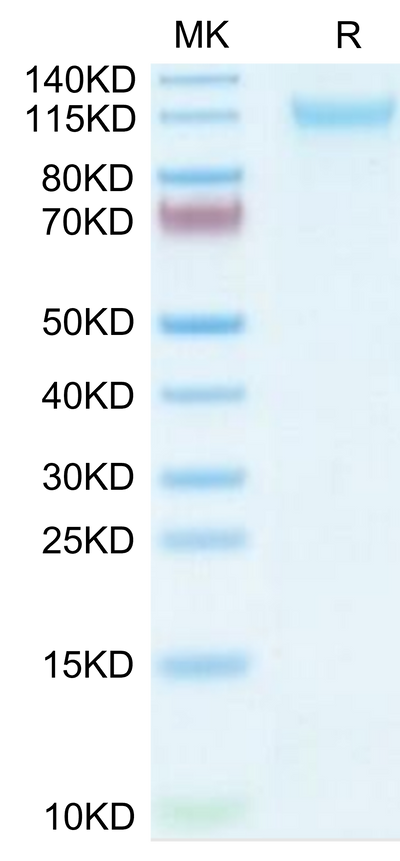 Mouse VLDLR on Tris-Bis PAGE under reduced condition. The purity is greater than 95%.Recombinant Mouse VLDLR Protein, Active