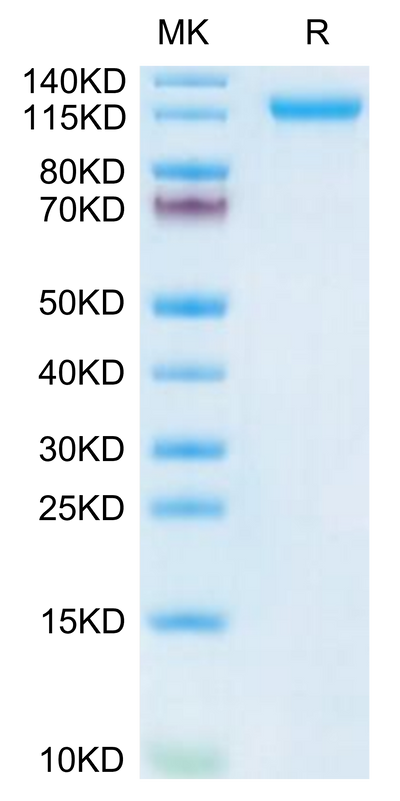 Human VLDLR on Tris-Bis PAGE under reduced condition. The purity is greater than 95%.Recombinant Human VLDLR Protein, Active