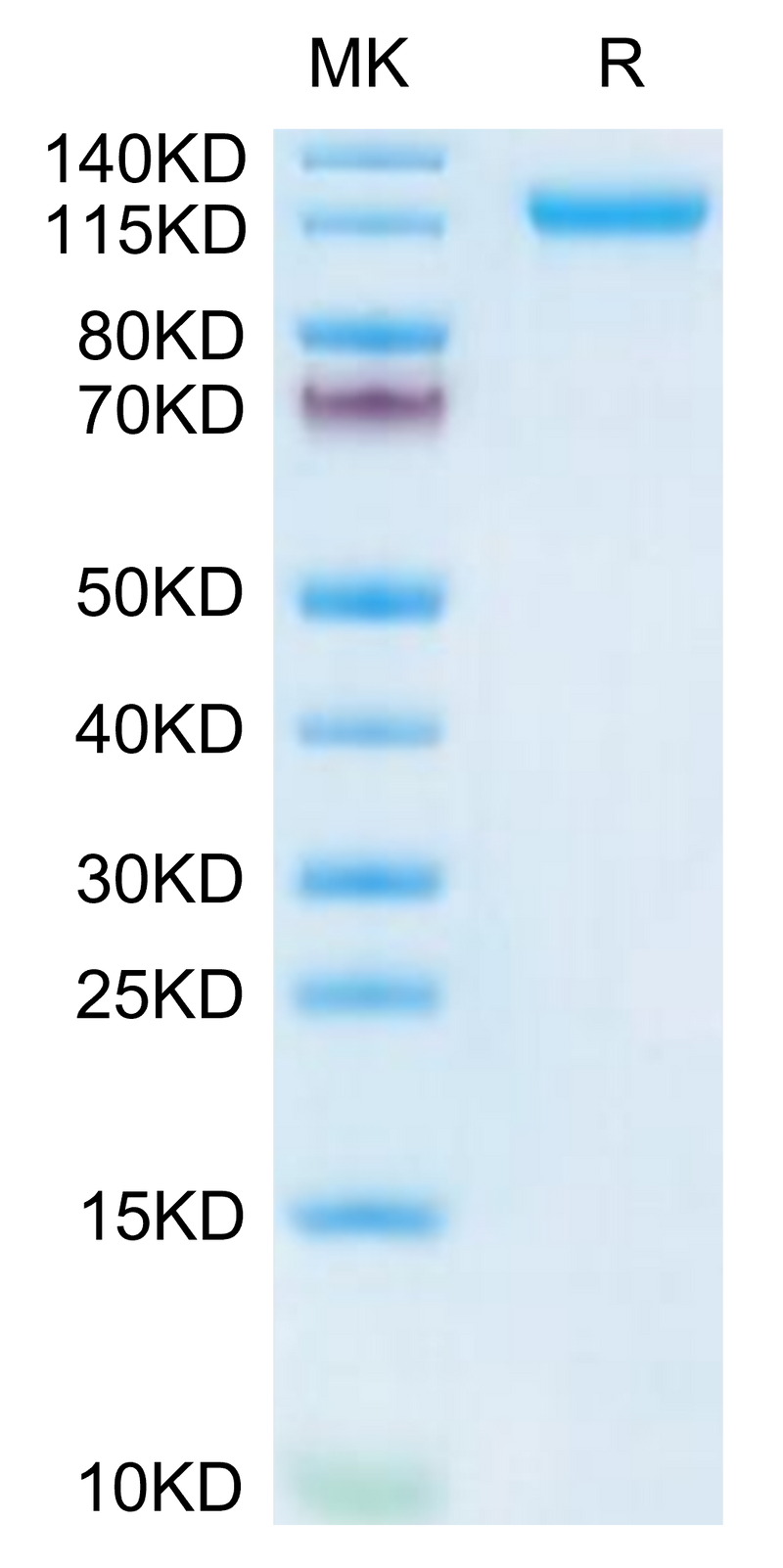 Human VLDLR on Tris-Bis PAGE under reduced condition. The purity is greater than 95%.Recombinant Human VLDLR Protein, Active