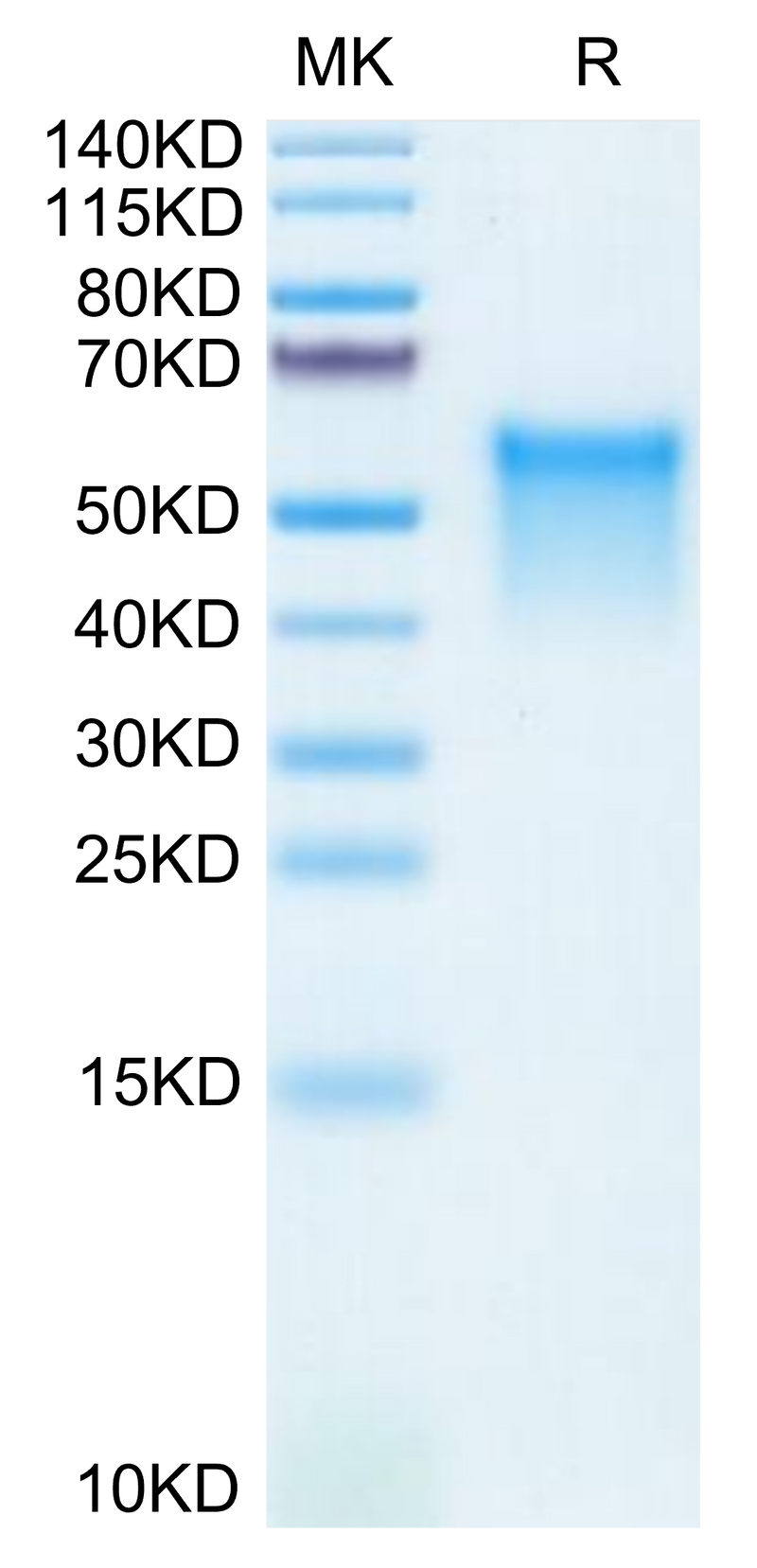Mouse GPVI on Tris-Bis PAGE under reduced condition. The purity is greater than 95%.Recombinant Mouse GPVI Protein