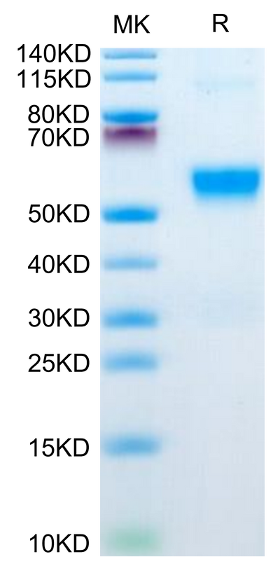 Human GPVI on Tris-Bis PAGE under reduced condition. The purity is greater than 95%.Recombinant Human GPVI Protein, Active