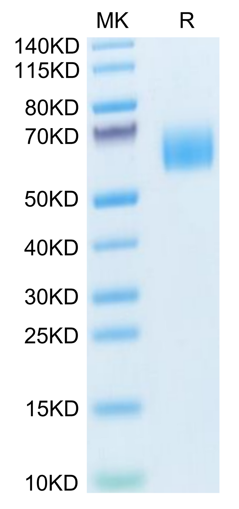 Human TYRO3 on Tris-Bis PAGE under reduced condition. The purity is greater than 95%.Recombinant Human TYRO3 Protein, Active