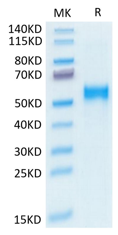 Human Kremen-2 on Tris-Bis PAGE under reduced condition. The purity is greater than 95%.Recombinant Human Kremen-2 Protein, Active