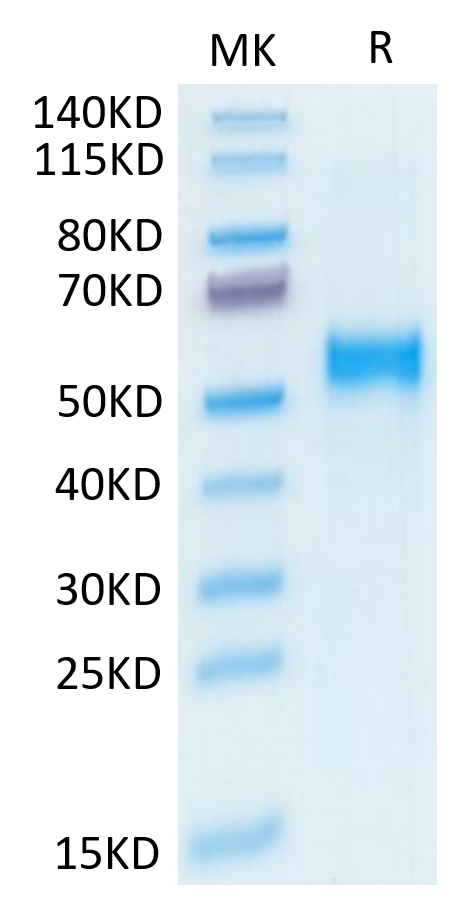 Human Kremen-2 on Tris-Bis PAGE under reduced condition. The purity is greater than 95%.Recombinant Human Kremen-2 Protein, Active