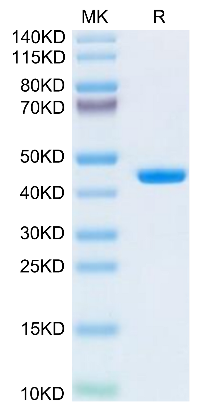 Human B2M on Tris-Bis PAGE under reduced condition. The purity is greater than 95%.Recombinant Human B2M/beta 2-Microglobulin Protein