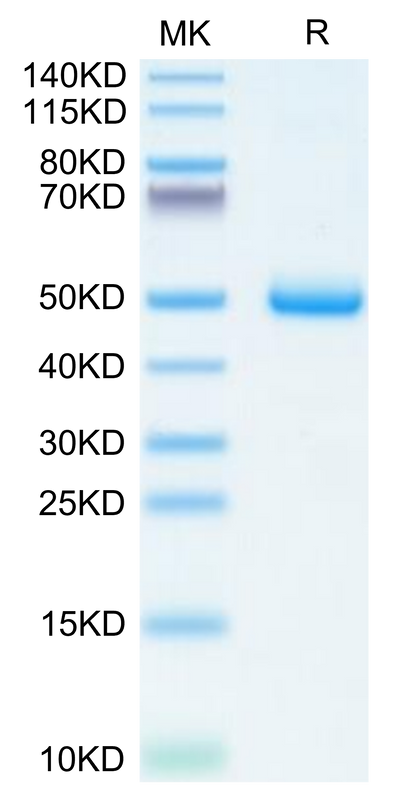 Human BAMBI on Tris-Bis PAGE under reduced condition. The purity is greater than 95%.Recombinant Human BAMBI Protein