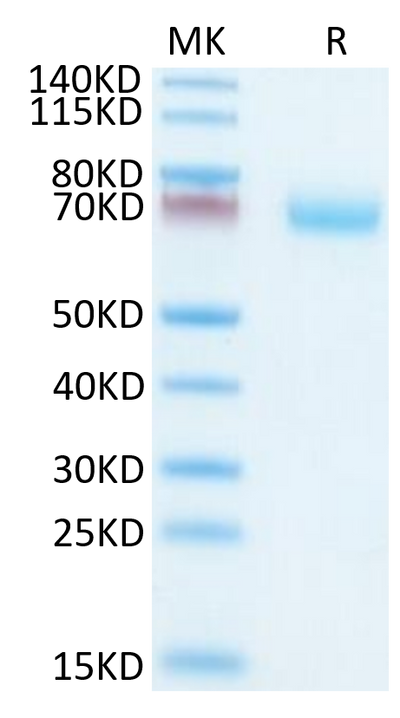 Mouse OSCAR on Tris-Bis PAGE under reduced condition. The purity is greater than 95%.Recombinant Mouse OSCAR Protein