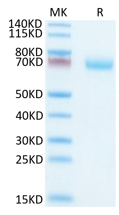Mouse OSCAR on Tris-Bis PAGE under reduced condition. The purity is greater than 95%.Recombinant Mouse OSCAR Protein