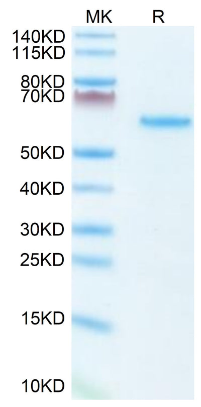 Mouse LTBR on Tris-Bis PAGE under reduced condition. The purity is greater than 95%.Recombinant Mouse LTBR Protein