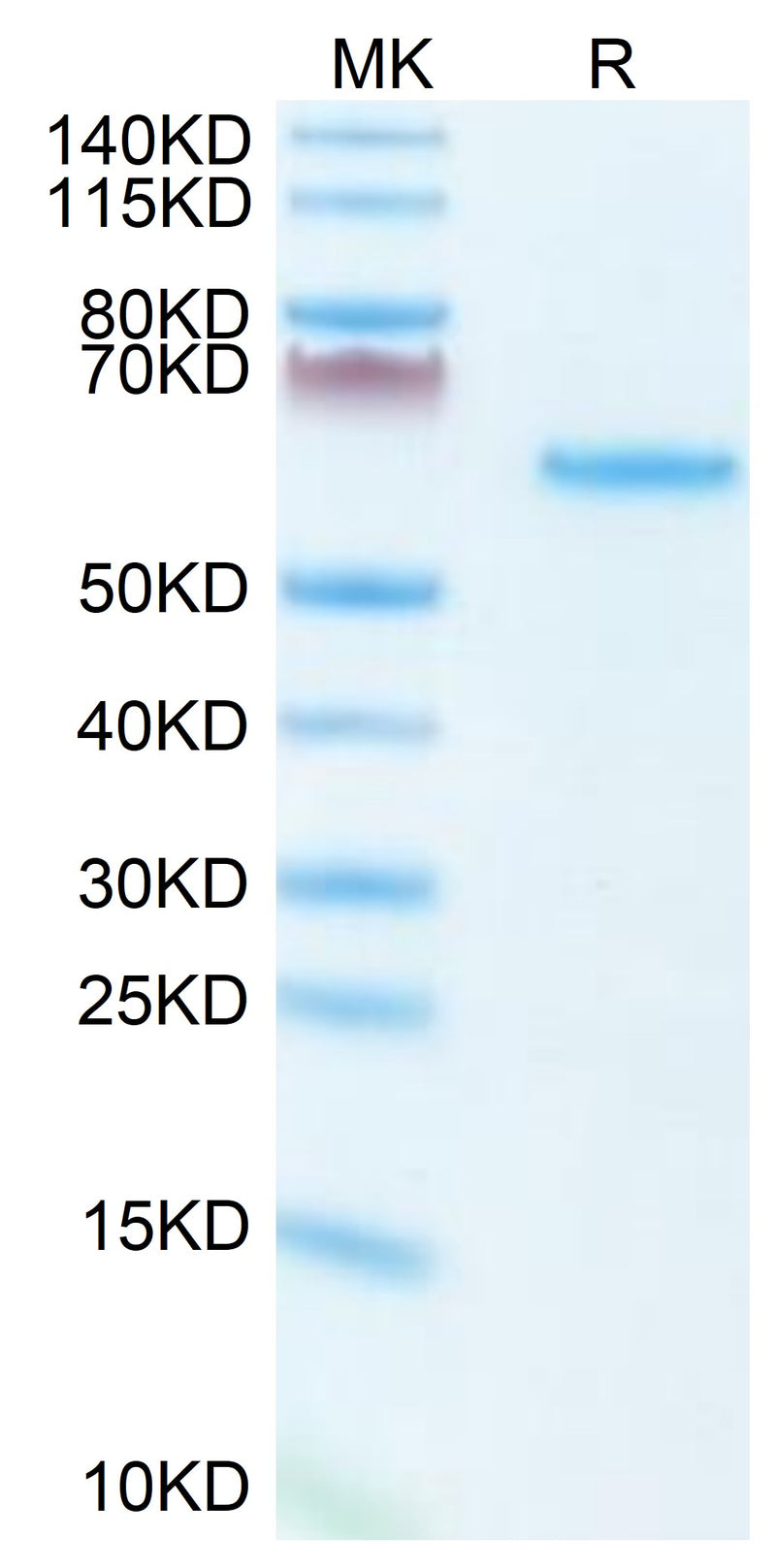 Mouse LTBR on Tris-Bis PAGE under reduced condition. The purity is greater than 95%.Recombinant Mouse LTBR Protein