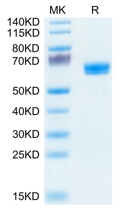 Human LTBR on Tris-Bis PAGE under reduced condition. The purity is greater than 95%.Recombinant Human LTBR Protein, Active