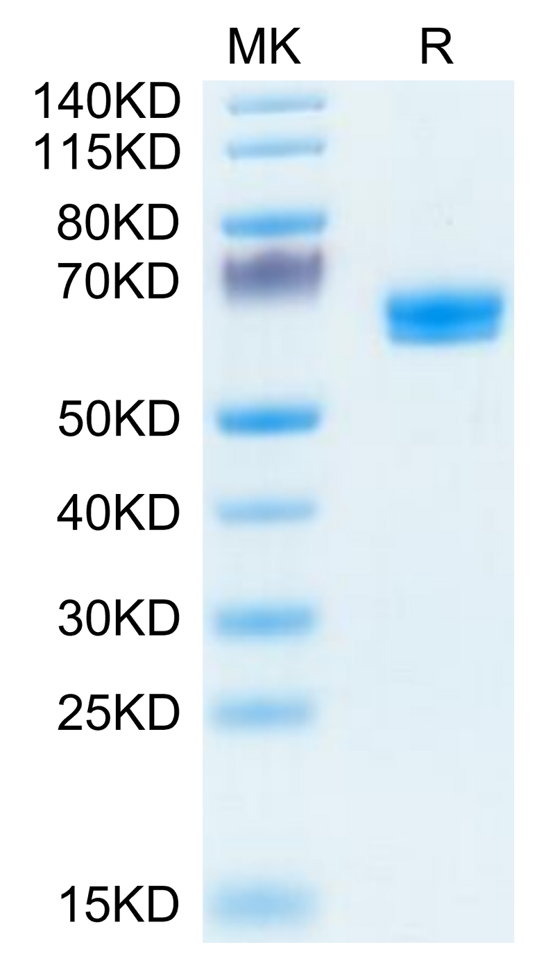 Human LTBR on Tris-Bis PAGE under reduced condition. The purity is greater than 95%.Recombinant Human LTBR Protein, Active