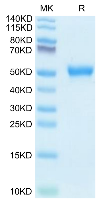 Human AGER on Tris-Bis PAGE under reduced condition. The purity is greater than 95%.Recombinant Human AGER Protein
