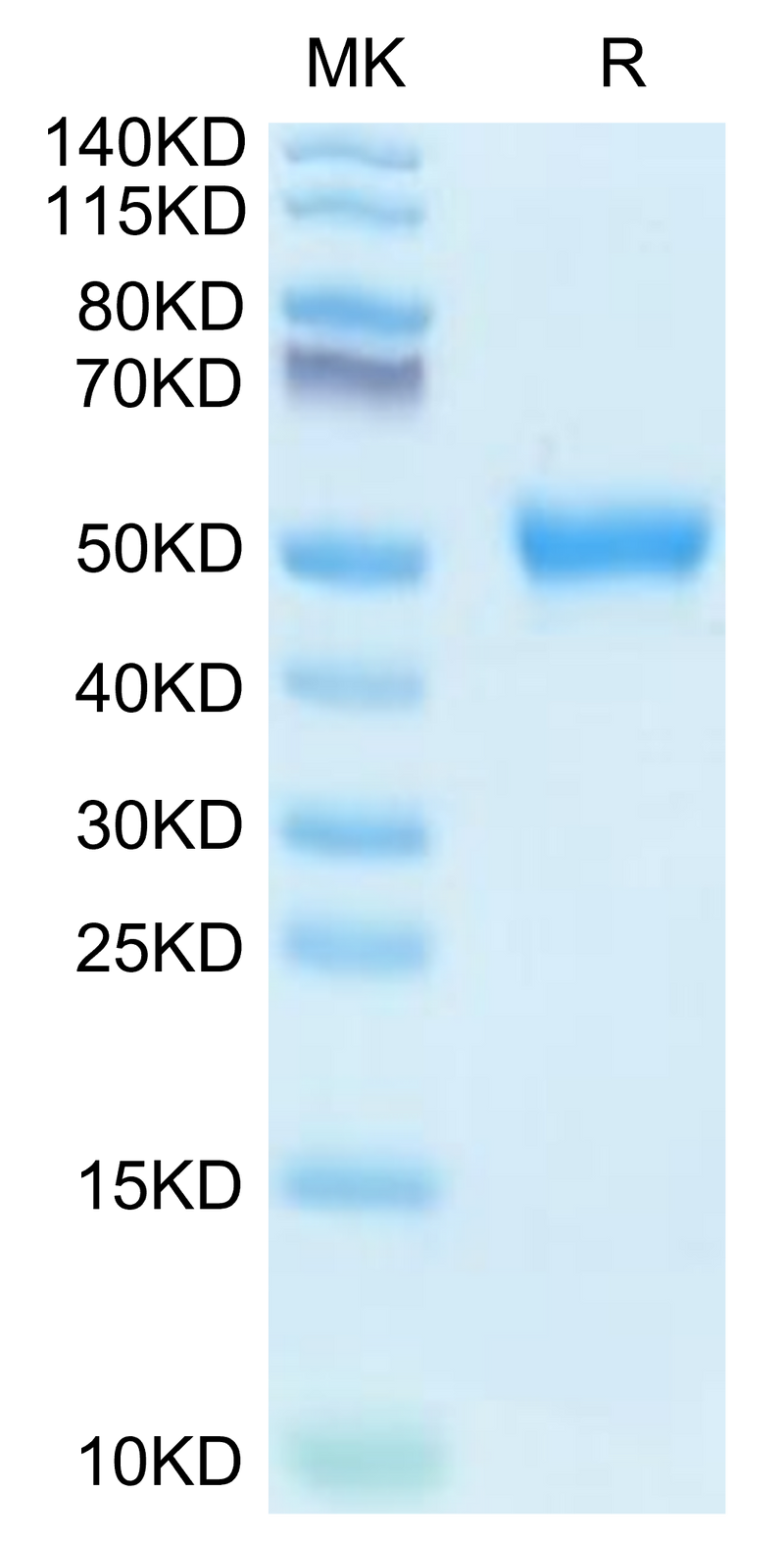 Human AGER on Tris-Bis PAGE under reduced condition. The purity is greater than 95%.Recombinant Human AGER Protein