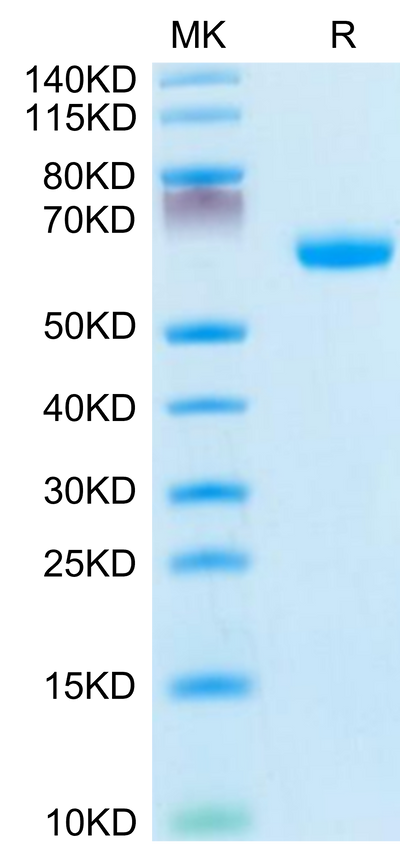 Mouse Ephrin-A3 on Tris-Bis PAGE under reduced condition. The purity is greater than 95%.Recombinant Mouse Ephrin-A3/EFNA3 Protein