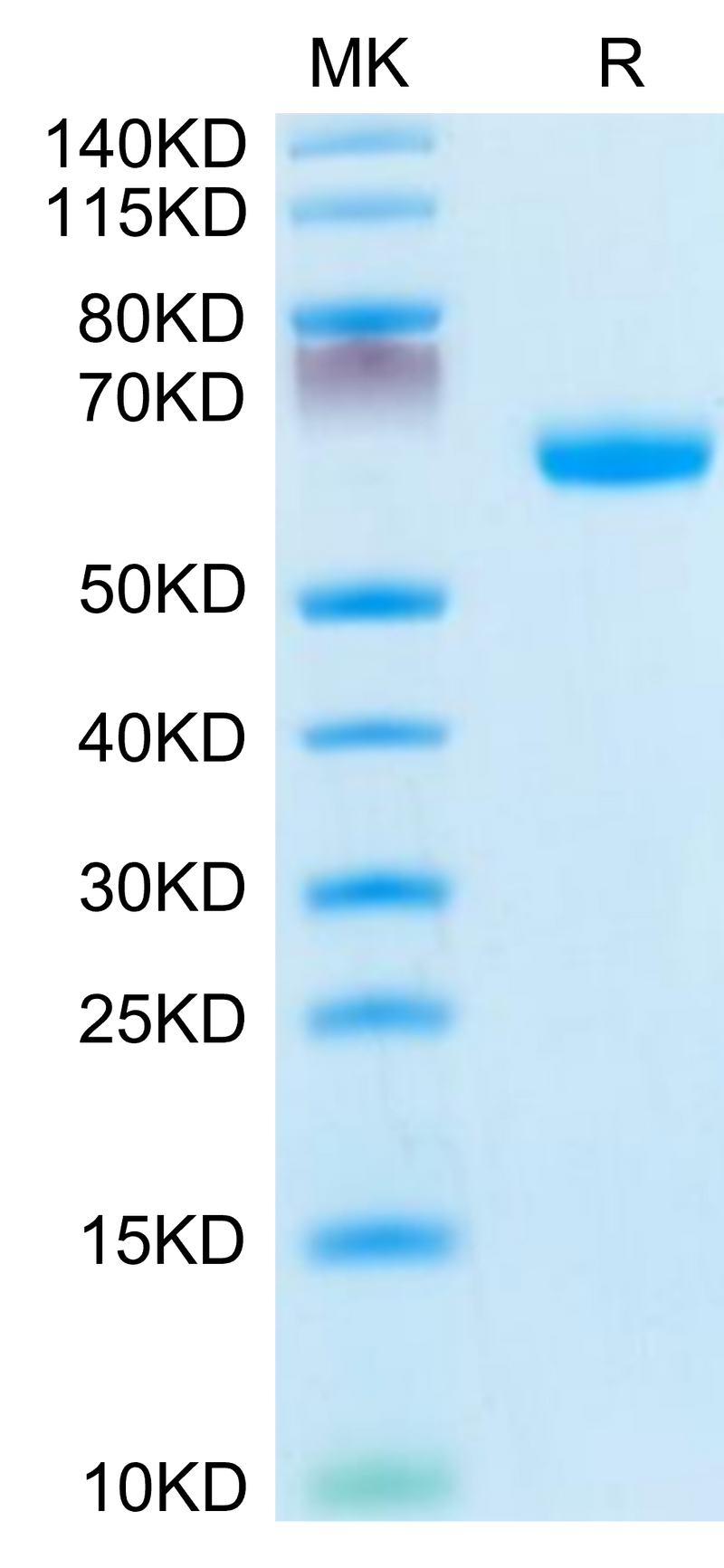 Mouse Ephrin-A3 on Tris-Bis PAGE under reduced condition. The purity is greater than 95%.Recombinant Mouse Ephrin-A3/EFNA3 Protein