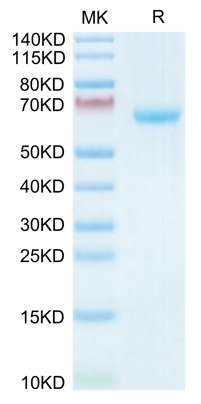 Human/Cynomolgus Ephrin-A3 on Tris-Bis PAGE under reduced condition. The purity is greater than 95%.Recombinant Human/Cynomolgus Ephrin-A3/EFNA3 Protein, Active