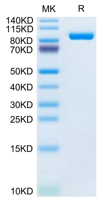 Mouse LRIG1 on Tris-Bis PAGE under reduced condition. The purity is greater than 95%.Recombinant Mouse LRIG1 Protein
