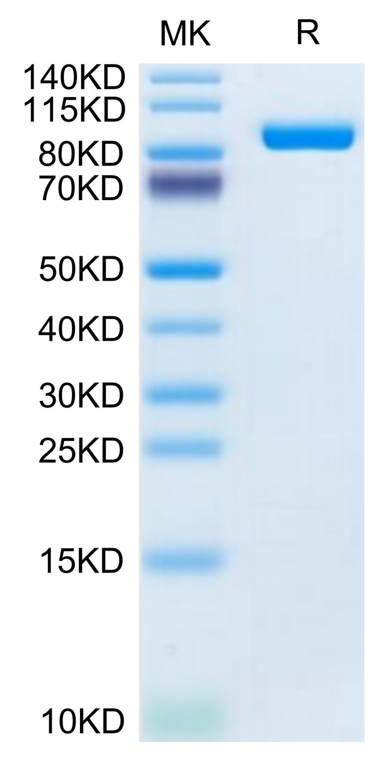Mouse LRIG1 on Tris-Bis PAGE under reduced condition. The purity is greater than 95%.Recombinant Mouse LRIG1 Protein