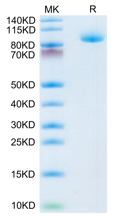 Human LRIG1 on Tris-Bis PAGE under reduced condition. The purity is greater than 95%.Recombinant Human LRIG1 Protein, Active