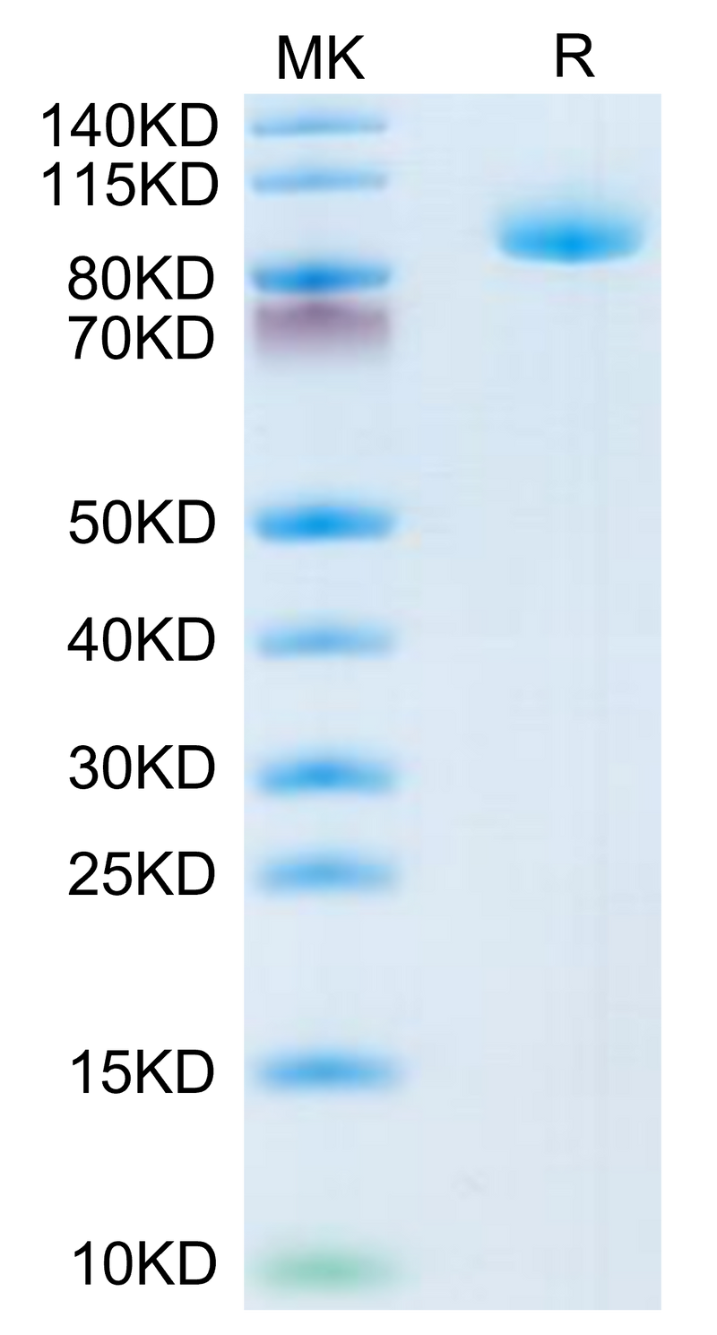 Human LRIG1 on Tris-Bis PAGE under reduced condition. The purity is greater than 95%.Recombinant Human LRIG1 Protein, Active
