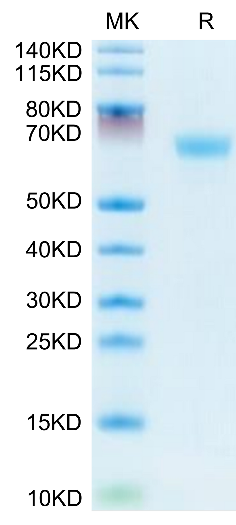 Mouse LAMP5 on Tris-Bis PAGE under reduced condition. The purity is greater than 95%.Recombinant Mouse LAMP5 Protein