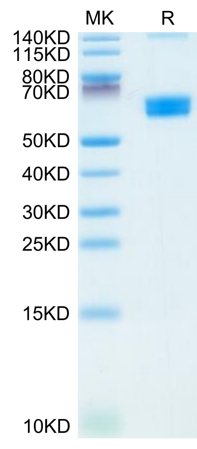 Mouse CLEC9A on Tris-Bis PAGE under reduced condition. The purity is greater than 95%.Recombinant Mouse CLEC9A Protein