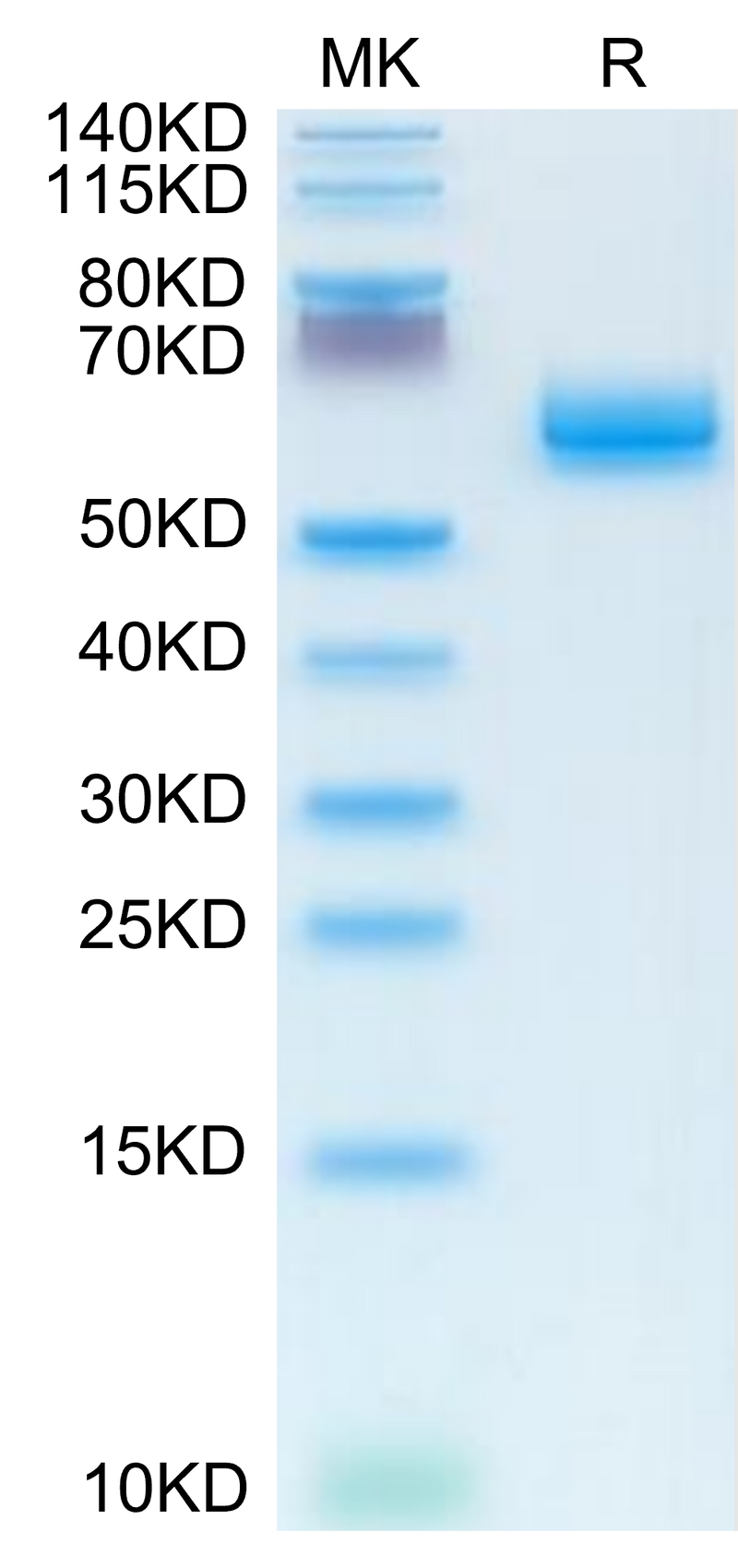 Human CLEC9A on Tris-Bis PAGE under reduced condition. The purity is greater than 95%.Recombinant Human CLEC9A Protein, Active