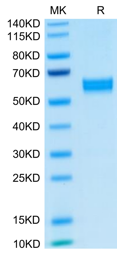 Human HGF on Tris-Bis PAGE under reduced condition. The purity is greater than 95%.Recombinant Human HGF Protein, Active