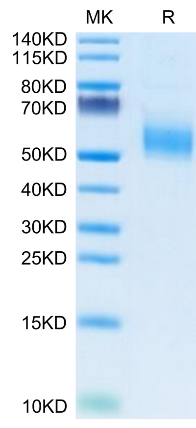 Human KLRG1 on Tris-Bis PAGE under reduced condition. The purity is greater than 95%.Recombinant Human KLRG1 Protein, Active