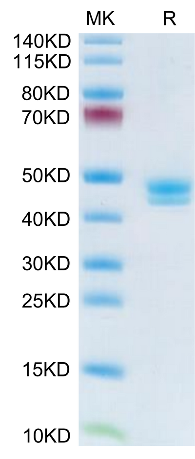 Human MCEMP1 on Tris-Bis PAGE under reduced condition. The purity is greater than 95%.Recombinant Human MCEMP1 Protein
