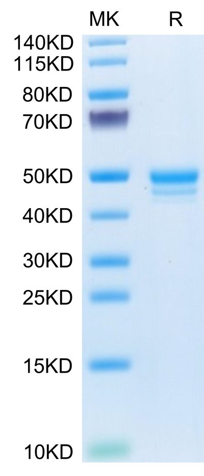 Mouse MCEMP1 on Tris-Bis PAGE under reduced condition. The purity is greater than 95%.Recombinant Mouse MCEMP1 Protein