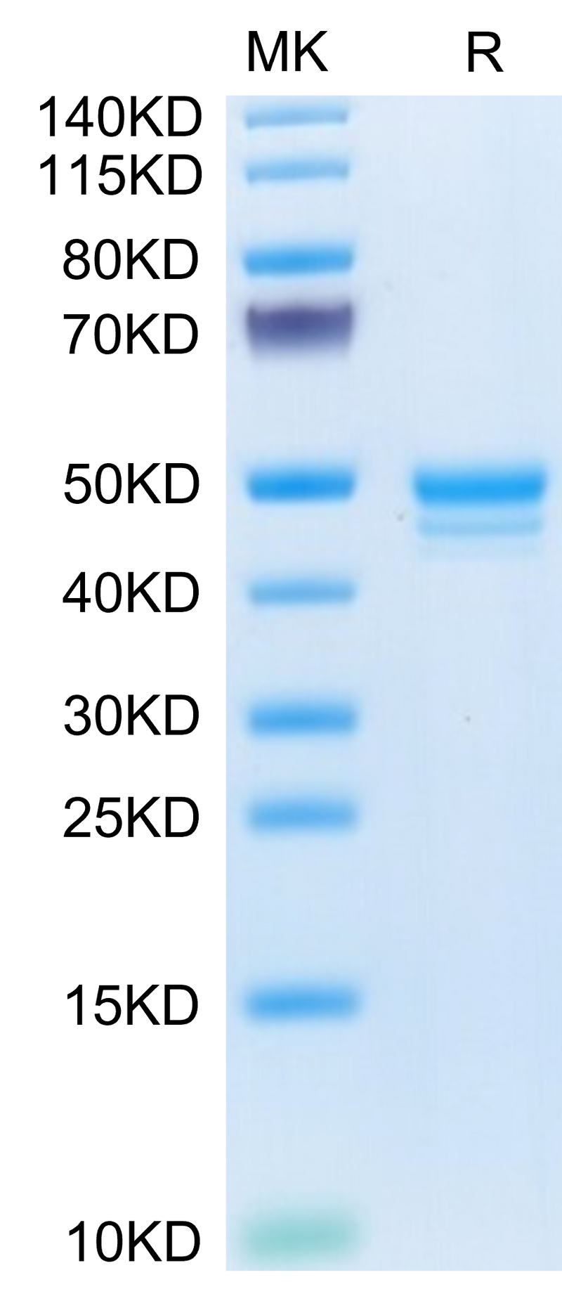 Mouse MCEMP1 on Tris-Bis PAGE under reduced condition. The purity is greater than 95%.Recombinant Mouse MCEMP1 Protein