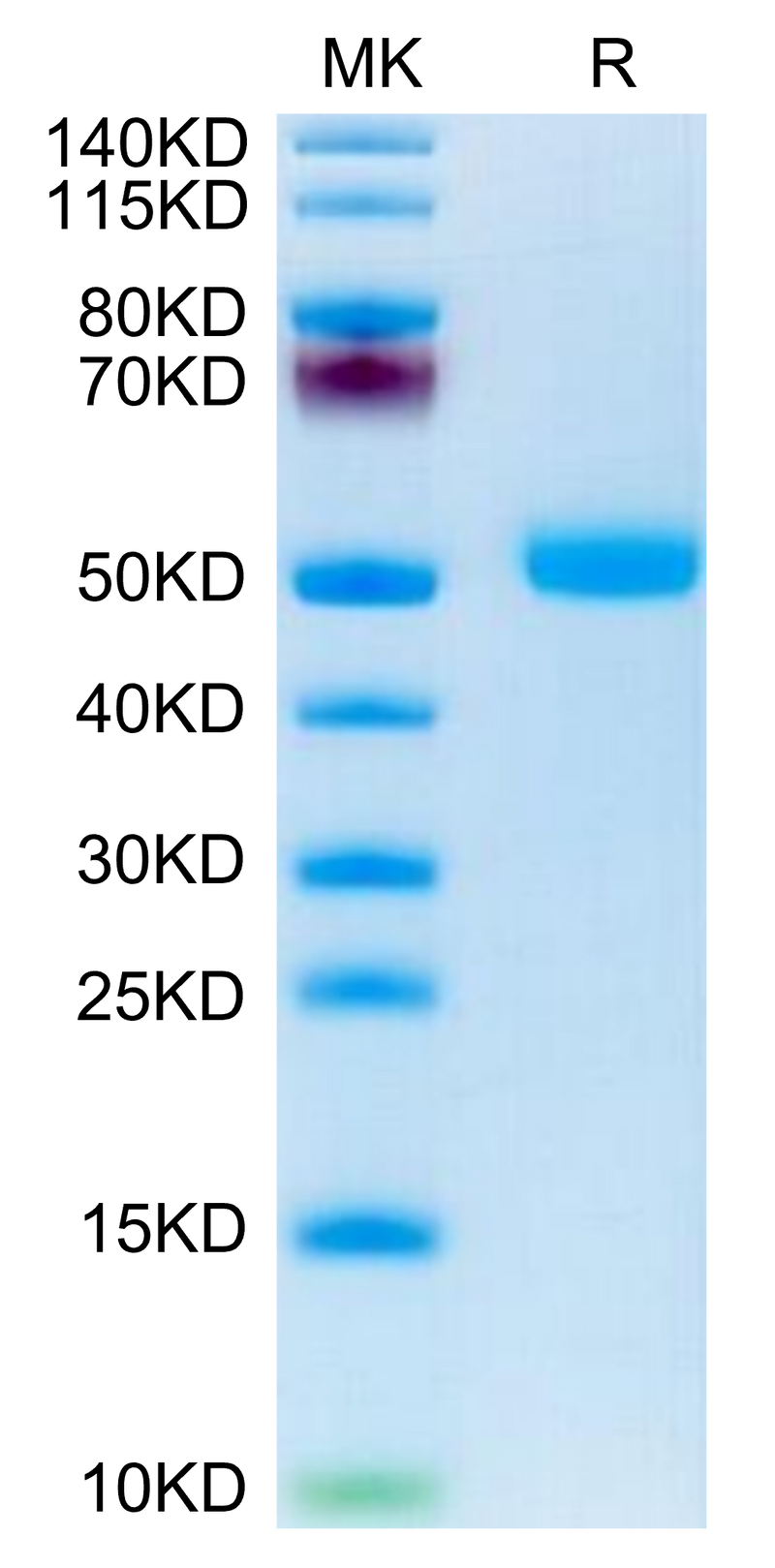 Human FSHB on Tris-Bis PAGE under reduced condition. The purity is greater than 95%.Recombinant Human FSHB Protein