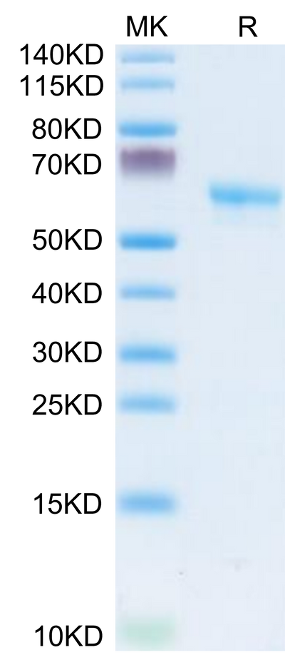 Human LAMP5 on Tris-Bis PAGE under reduced condition. The purity is greater than 95%.Recombinant Human LAMP5 Protein