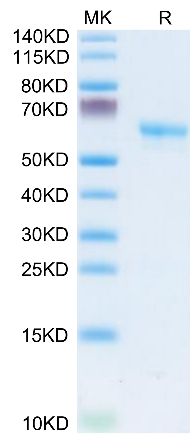 Human LAMP5 on Tris-Bis PAGE under reduced condition. The purity is greater than 95%.Recombinant Human LAMP5 Protein