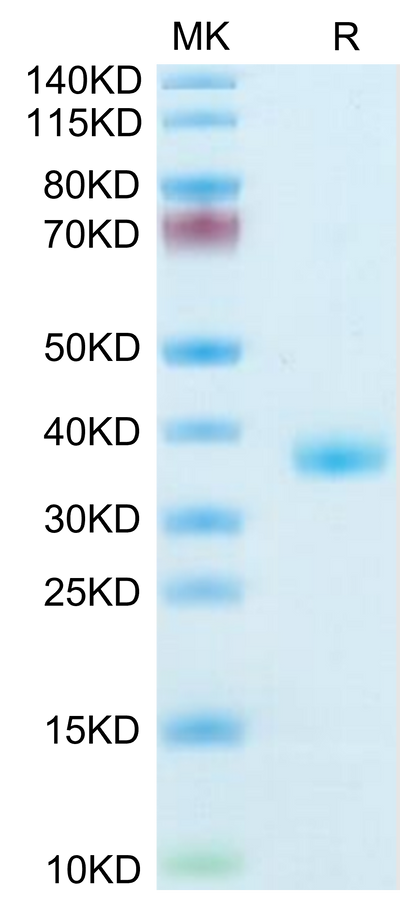 Mouse IGFBP2 on Tris-Bis PAGE under reduced condition. The purity is greater than 95%.Recombinant Mouse IGFBP2 Protein