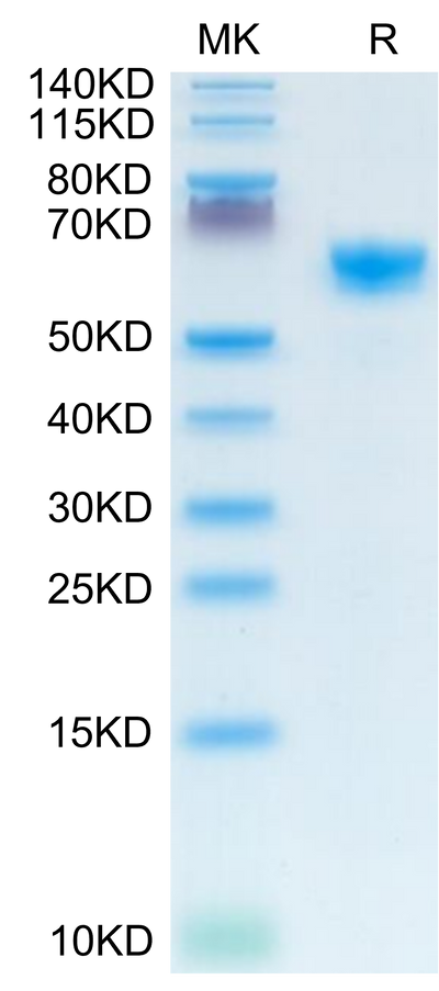 Mouse IGFBP-3R on Tris-Bis PAGE under reduced condition. The purity is greater than 95%.Recombinant Mouse IGFBP-3R Protein