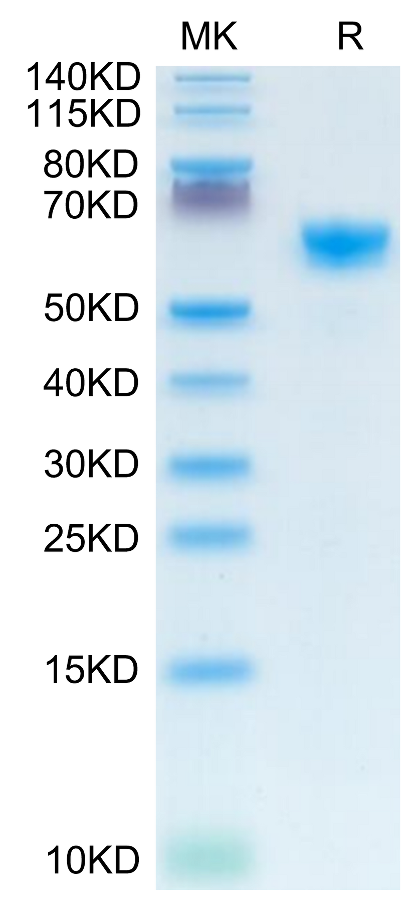 Mouse IGFBP-3R on Tris-Bis PAGE under reduced condition. The purity is greater than 95%.Recombinant Mouse IGFBP-3R Protein