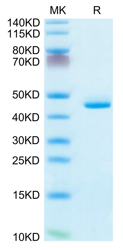 Human CD5L on Tris-Bis PAGE under reduced condition. The purity is greater than 95%.Recombinant Human CD5L Protein